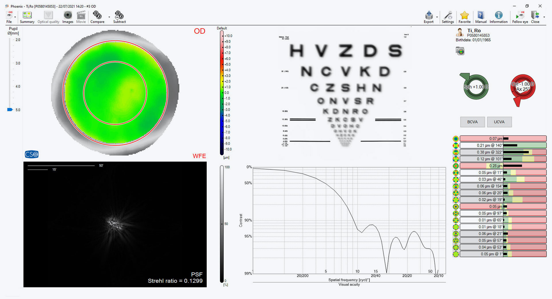 L'aberromètre capture jusqu'à 33 images par seconde lors d'un processus de mesure sans contact.